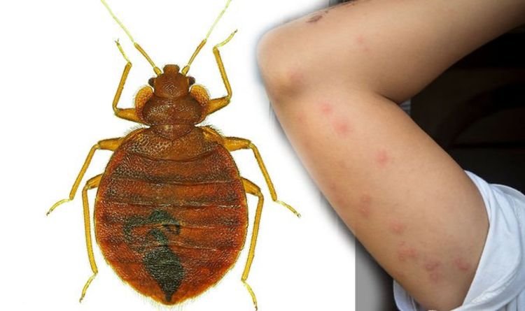 Jasa Pembasmi Kutu Busuk atau Kutu Kasur (Bed Bugs)